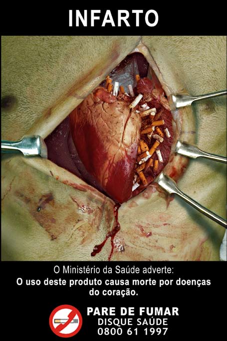 Brazil 2008 Health Effects heart - heart attack, open heart, graphic